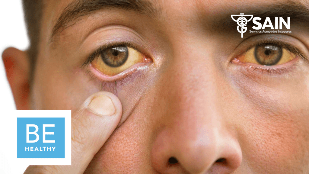 Entendiendo la Hepatitis: Concientización, Prevención y Tratamiento